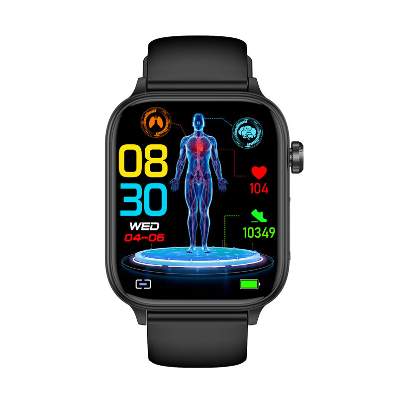 Professional ECG health intelligent micro examination smart watch ET570