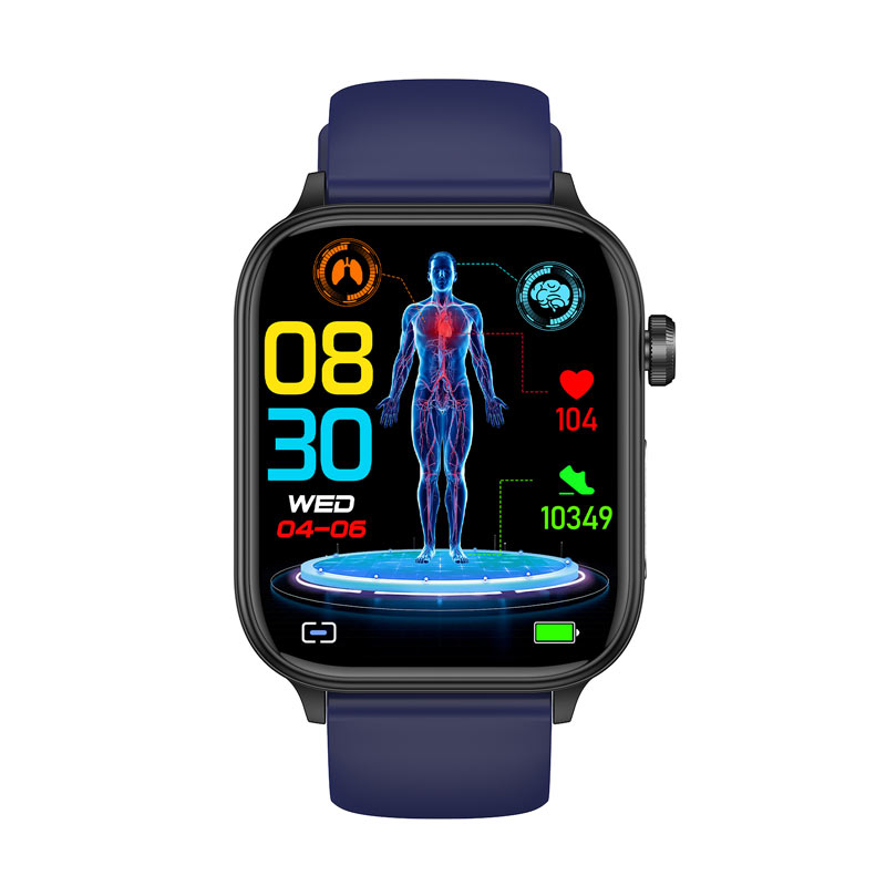 Professional ECG health intelligent micro examination smart watch ET570